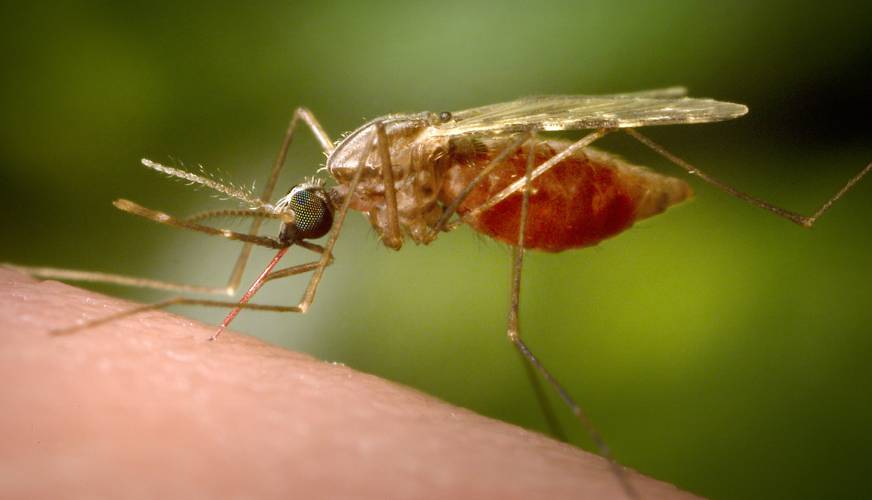 CDC VIA AP/JAMES GATHANY CDC VIA AP/JAMES GATHANY